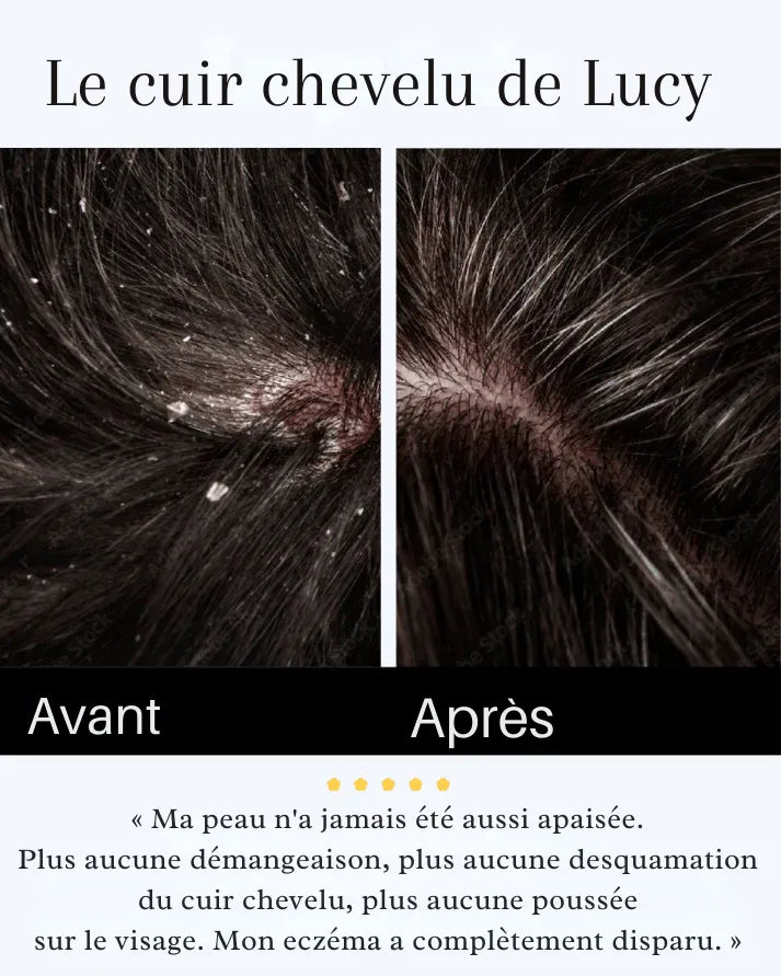 Sérum Apaisant Naturel
