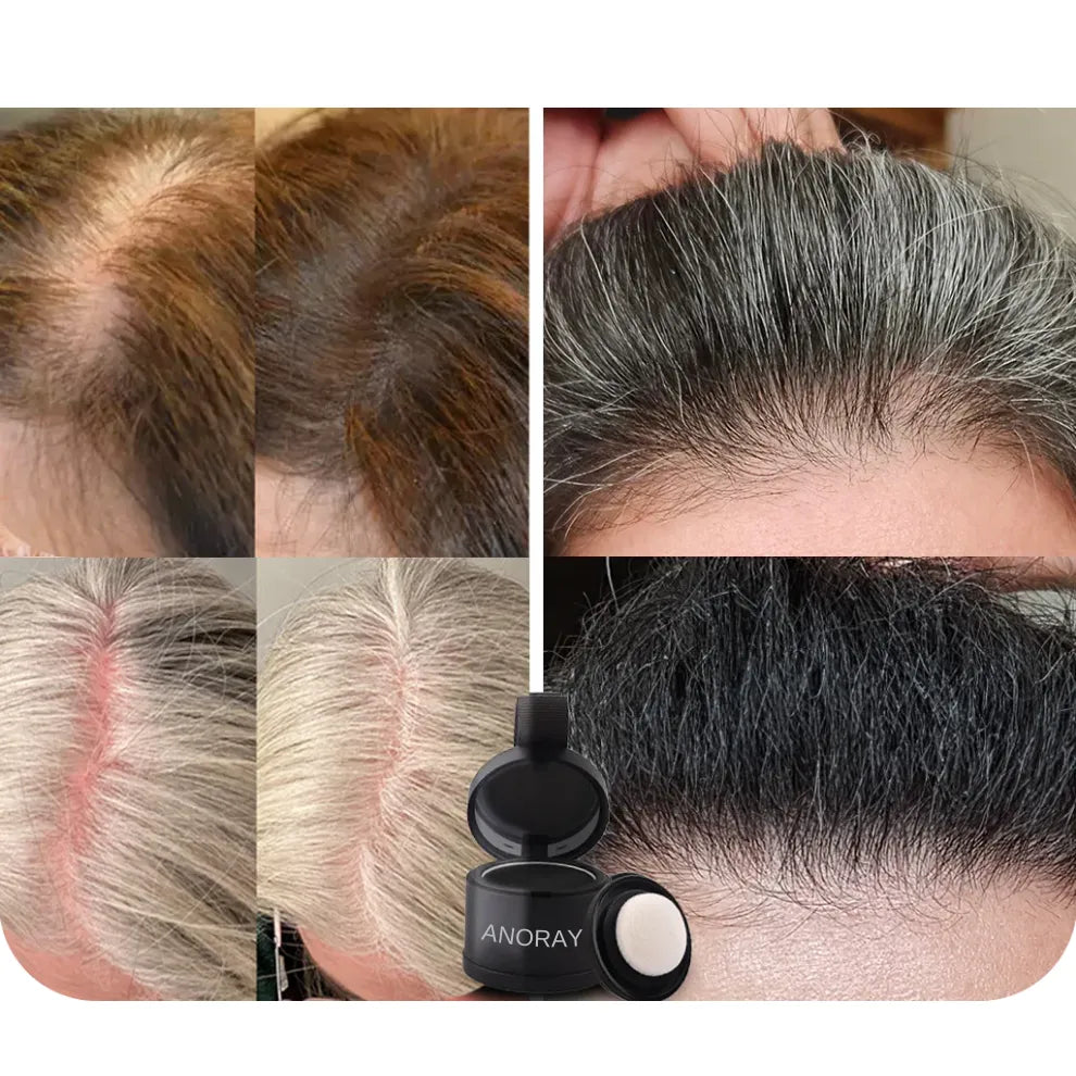 Anoraya™ – Couverture instantanée des racines et des cheveux gris