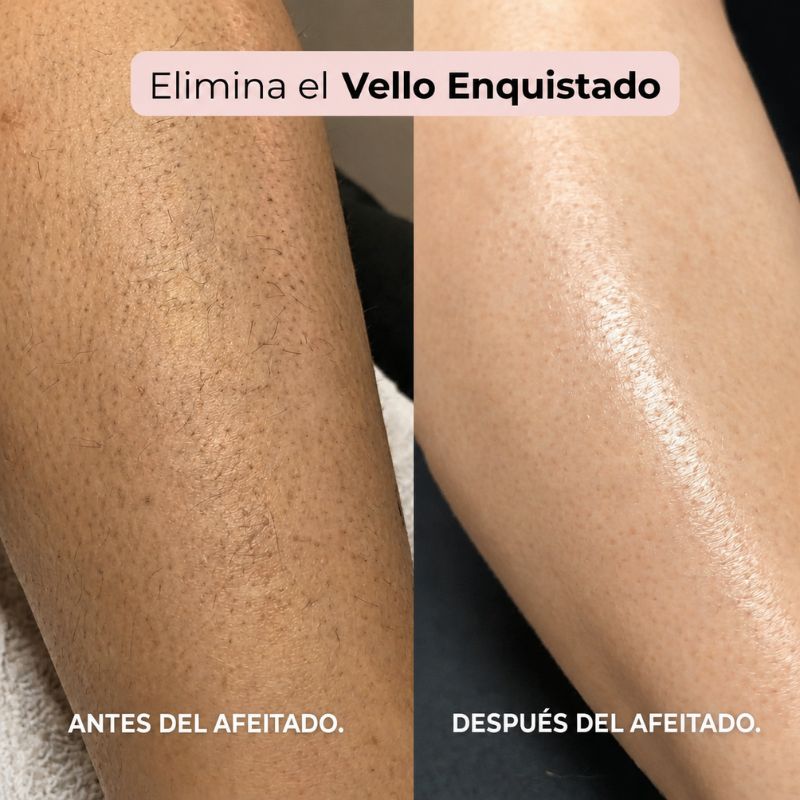 Afeitadora 2 en 1 para zona del bikini y cuerpo Shavea™
