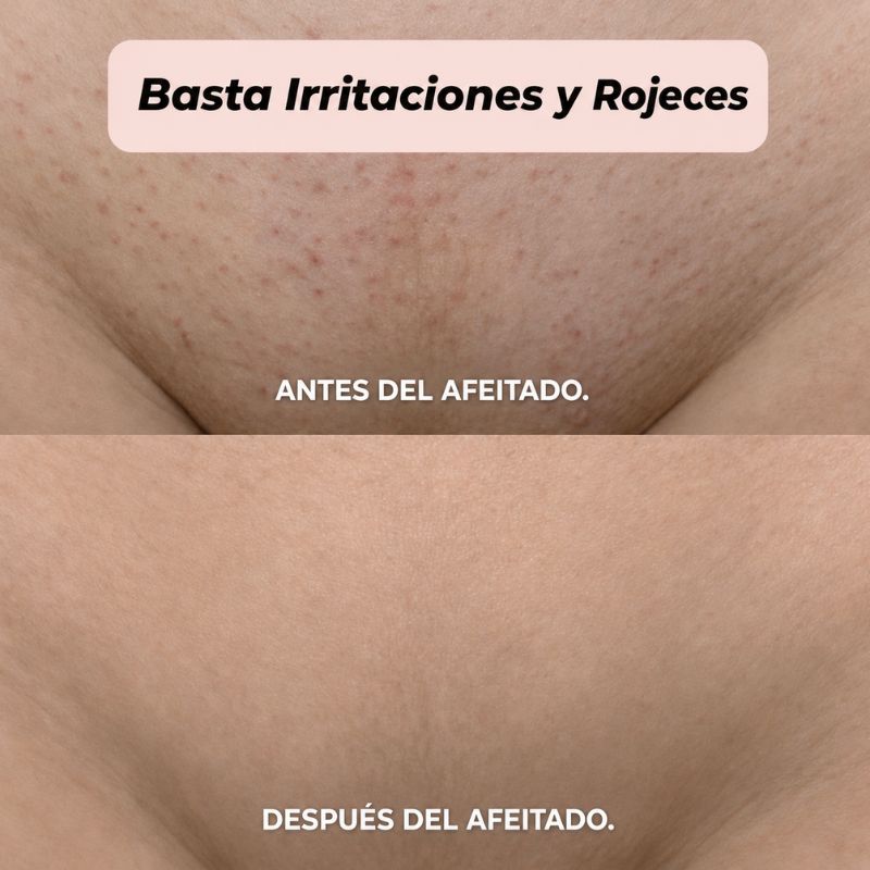 Afeitadora 2 en 1 para zona del bikini y cuerpo Shavea™